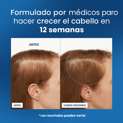 FortiGrow® - Roll On de Crecimiento Capilar™